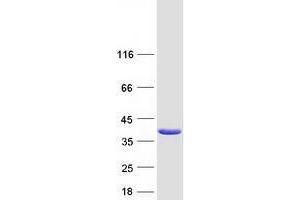Validation with Western Blot