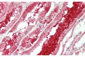 Detection of CX3CL1 in Human Kidney Tissue using Polyclonal Antibody to Chemokine C-X3-C-Motif Ligand 1 (CX3CL1)