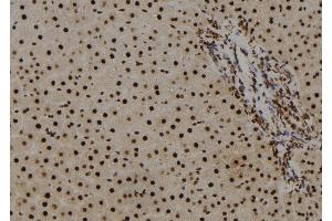 ABIN6278580 at 1/100 staining Rat liver tissue by IHC-P. (HIST1H2BH anticorps  (N-Term))