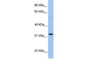 WB Suggested Anti-DNALI1 Antibody Titration: 0. (DNALI1 anticorps  (C-Term))
