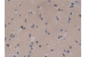 Detection of IGFBP1 in Human Brain Tissue using Polyclonal Antibody to Insulin Like Growth Factor Binding Protein 1 (IGFBP1)