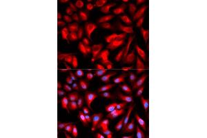 Immunofluorescence analysis of U2OS cells using CD168/RHAMM antibody (ABIN6131278, ABIN6141879, ABIN6141880 and ABIN6216074).
