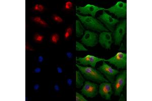ABIN7094501 and ABIN7098550 staining  cells by IF/ICC. (PRDM16 anticorps  (Internal Region))