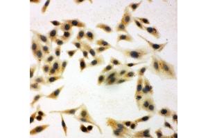 ICC testing of NRG1 antibody and HeLa cells (Neuregulin 1 anticorps  (C-Term))