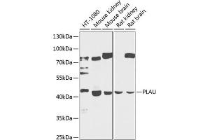 Western blot analysis of extracts of various cell lines, using PLAU antibody (ABIN3023141, ABIN3023142, ABIN3023143 and ABIN6219409) at 1:1000 dilution. (PLAU anticorps  (AA 20-180))