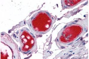 Small intestine, vessels: Formalin-Fixed, Paraffin-Embedded (FFPE)