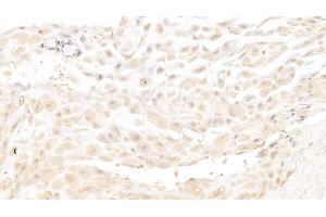 Detection of MBP in Human Placenta Tissue using Monoclonal Antibody to Major Basic Protein (MBP) (Major Basic Protein anticorps  (AA 105-222))