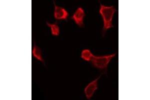 ABIN6268924 staining HeLa by IF/ICC. (TNFSF13 anticorps  (Internal Region))