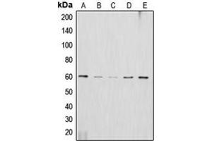Western blot analysis of AKT2 expression in HeLa (A), HepG2 (B), NIH3T3 (C), mouse brain (D), rat brain (E) whole cell lysates. (AKT2 anticorps  (C-Term))