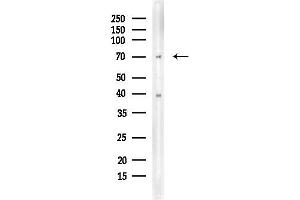 Western blot analysis of lysates from COLO205 cells, using Phospho-C-RAF (Ser296) Antibody at 1/1000 dilution.