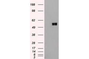 Image no. 4 for anti-Keratin 8 (KRT8) (AA 91-381) antibody (ABIN1491713)