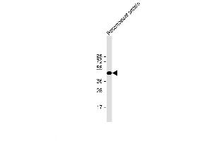 H1L recombinant protein probed with H1L (20CT26. (Tyr/ser Protein Phosphatase anticorps)