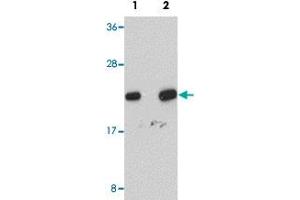 Western blot analysis of human liver tissue with NDUFB9 polyclonal antibody  at (Lane 1) 1 and (Lane 2) 2 ug/mL dilution. (NDUFB9 anticorps  (C-Term))