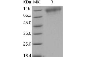 Western Blotting (WB) image for Neurotrophic tyrosine Kinase, Receptor, Type 3 (NTRK3) (Active) protein (His tag) (ABIN7320316)