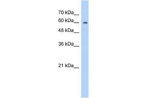WB Suggested Anti-ATIC Antibody Titration:  1. (ATIC anticorps  (N-Term))