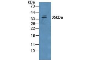 Western blot analysis of Human Serum. (GDF15 anticorps  (AA 195-308))