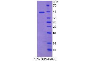 SDS-PAGE analysis of Human NRCAM Protein. (NrCAM Protéine)