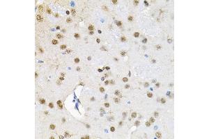 Immunohistochemistry of paraffin-embedded rat brain using Smarcd1 antibody (ABIN6132669, ABIN6137420, ABIN6137421 and ABIN6225284) (40x lens).