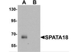 Western blot analysis of SPATA18 in rat lung tissue lysate with SPATA18 antibody at 1 ug/mL in (A) the absence and (B) the presence of blocking peptide (SPATA18 anticorps  (N-Term))