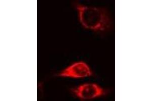 ABIN6275640 staining Hela cells by IF/ICC. (MTERF anticorps  (Internal Region))