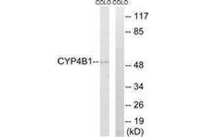 Western blot analysis of extracts from COLO cells, using Cytochrome P450 4B1 Antibody. (CYP4B1 anticorps  (AA 141-190))
