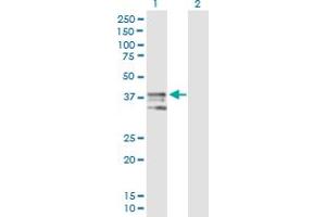 Western Blot analysis of ART4 expression in transfected 293T cell line by ART4 MaxPab polyclonal antibody. (ART4 anticorps  (AA 1-314))