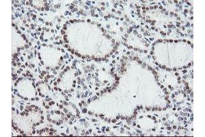 Image no. 1 for anti-Negative Regulator of Ubiquitin-Like Proteins 1 (NUB1) (AA 1-326) antibody (ABIN1490743) (NUB1 anticorps  (AA 1-326))