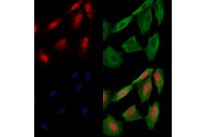 Phospho-MAP3K3 (Ser166) Antibody staining A549 cells(H2O2 treatment) by IF/ICC. (MAP3K3 anticorps  (pSer166))