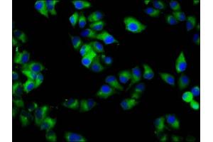 Immunofluorescence staining of Hela cells with ABIN7167381 at 1:133, counter-stained with DAPI. (RAB7B anticorps  (AA 100-199))