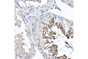 Immunohistochemistry of paraffin-embedded mouse testis using GNB2 Rabbit pAb  at dilution of 1:100 (40x lens).