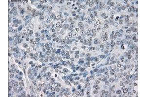 Image no. 12 for anti-Protein Phosphatase 5, Catalytic Subunit (PPP5C) antibody (ABIN1500390)