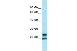 WB Suggested Anti-YRDC Antibody Titration: 1. (YRDC anticorps  (Middle Region))