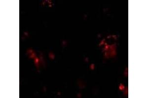 Immunofluorescent staining of DcR1 in rat liver tissue with DcR1 antibody at 10μg/ml. (DcR1 anticorps)