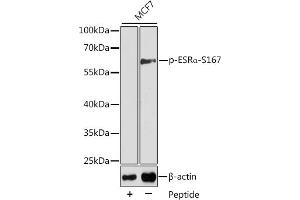 Western blot analysis of extracts from MCF7 cells using Phospho-ESRα-S167 antibody (ABIN3020207, ABIN3020208, ABIN3020209 and ABIN7101869). (Estrogen Receptor alpha anticorps  (pSer167))