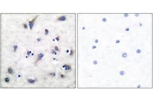 Immunohistochemistry analysis of paraffin-embedded human brain, using DARPP-32 (Phospho-Thr34) Antibody. (DARPP32 anticorps  (pThr34))