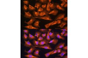 Immunofluorescence analysis of U2OS cells using RPS28 Rabbit pAb (ABIN7270024) at dilution of 1:100.