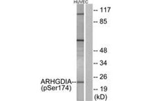 Western blot analysis of extracts from HuvEc cells treated with EGF 200ng/ml 30', using ARHGDIA (Phospho-Ser174) Antibody. (ARHGDIA anticorps  (pSer174))