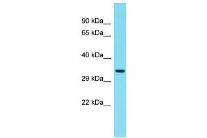 Host: Rabbit Target Name: C6orf136 Sample Type: Fetal Kidney lysates Antibody Dilution: 1. (C6ORF136 anticorps  (C-Term))