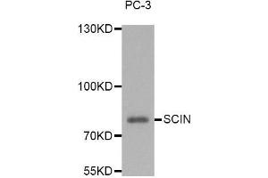 Western blot analysis of extracts of PC-3 cell line, using SCIN antibody. (Scinderin anticorps)