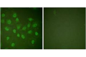Immunofluorescence analysis of HeLa cells, using POLR2A (Ab-1619) Antibody. (POLR2A/RPB1 anticorps  (AA 1585-1634))