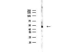 anti-Receptor-Associated Protein of The Synapse (RAPSN) (C-Term) antibody