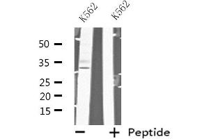 Western blot analysis of extracts from K562 cells, using MAD2L1BP antibody. (MAD2L1BP anticorps  (N-Term))
