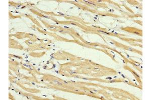 IHC image of ABIN7160149 diluted at 1:400 and staining in paraffin-embedded human heart tissue performed on a Leica BondTM system. (ABHD6 anticorps  (AA 105-211))