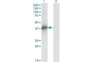 anti-Cell Growth Regulator with Ring Finger Domain 1 (CGRRF1) (AA 1-332) antibody
