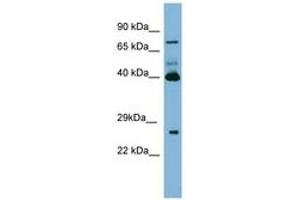 Image no. 1 for anti-Transglutaminase 3 (E Polypeptide, Protein-Glutamine-gamma-Glutamyltransferase) (TGM3) (N-Term) antibody (ABIN6741686) (TGM3 anticorps  (N-Term))