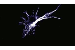 Immunofluorescence staining of mouse macrophages.