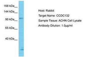 Image no. 1 for anti-Coiled-Coil Domain Containing 132 (CCDC132) (N-Term) antibody (ABIN6750636) (Syndetin/VPS50 anticorps  (N-Term))