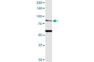 TRPV5 monoclonal antibody (M02), clone 2A6.