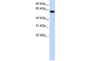 WB Suggested Anti-CCDC11 Antibody Titration: 0. (CCDC11 anticorps  (N-Term))