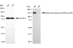 Western blotting analysis using adenosine deaminase RNA specific antibody (ABIN7797516). (Recombinant ADAR anticorps)